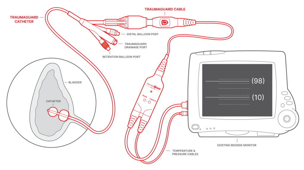 Trauma Guard System TraumaGuard System for Burn Care - Sentinel